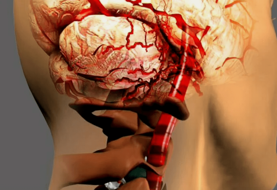 Come osteocondosi cervicale, è pericoloso