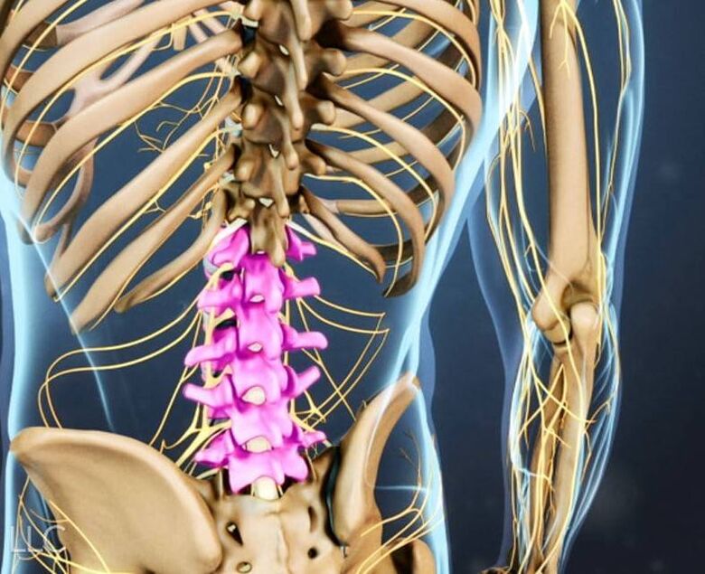 Osteocondrosi della colonna lombare