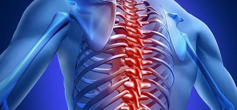 Osteocondrosi della colonna vertebrale toracica